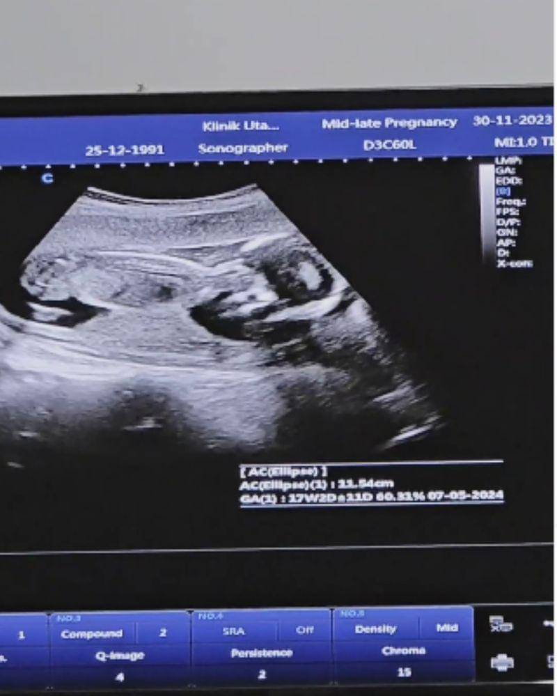 Instagram.com/@ichasoebandono